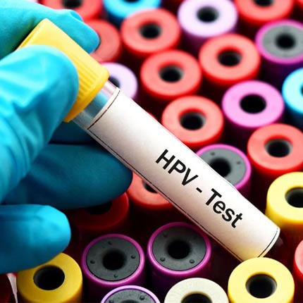 همه چیز درباره ویروس HPV