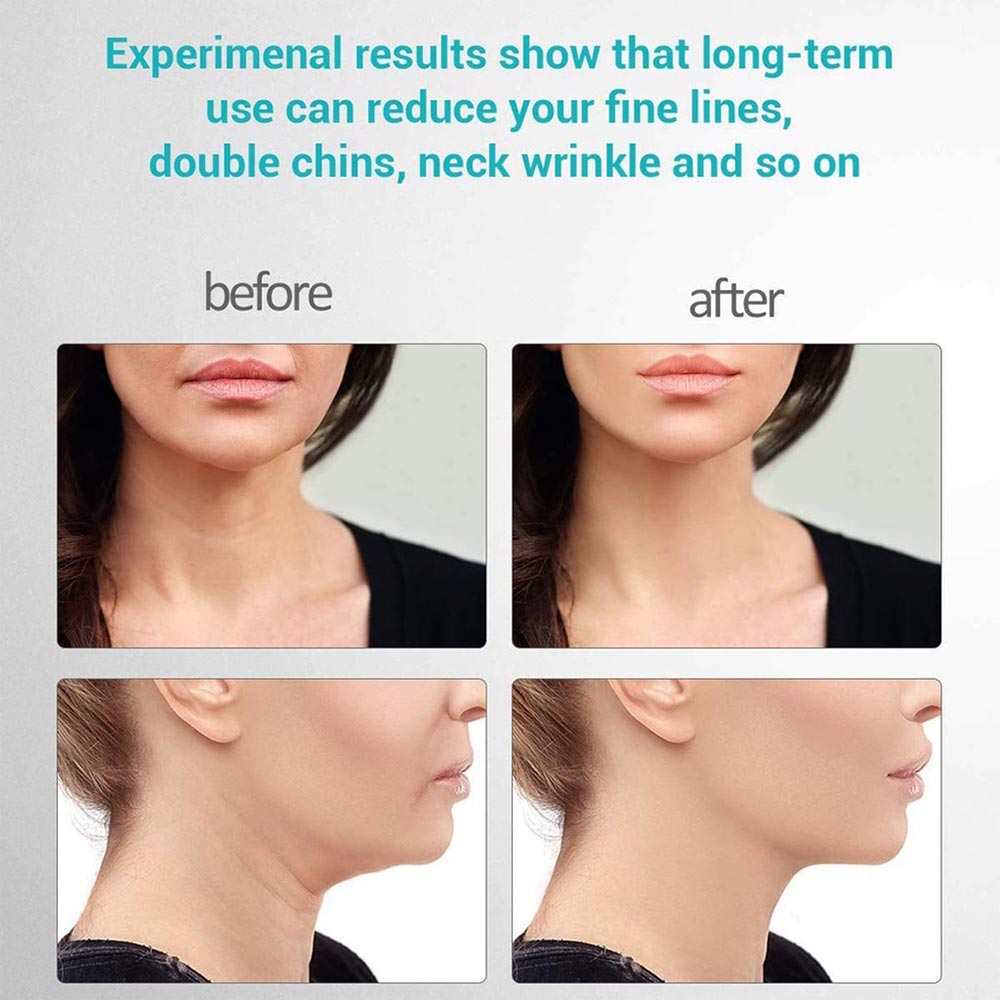 دستگاه لیفت صورت و گردن (Neck Beauty) شین